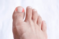 Dealing With Ingrown Toenails