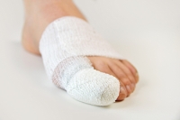 What to Do if You Break Your Toe